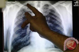 Crucial to examine TB patients’ close contacts: Health Ministry